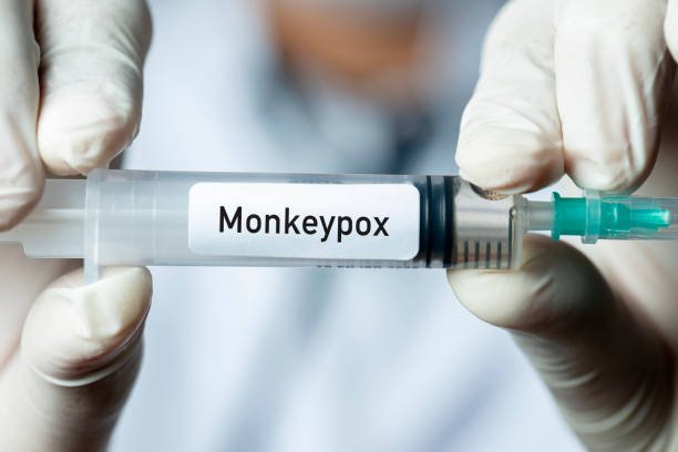 Cegah Penyebaran Cacar Monyet, Lakukan Tips Ini