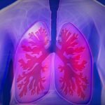 Foto: Ilustrasi penyakit Pneumonia (Sumber: pixabay) Foto: Ilustrasi penyakit Pneumonia (Sumber: pixabay)