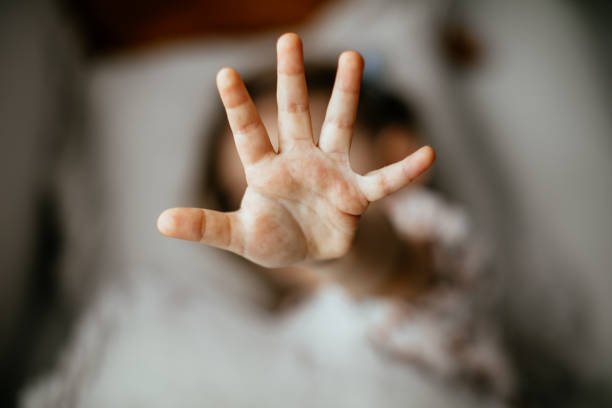 Ilustrasi korban penganiayaan/istock