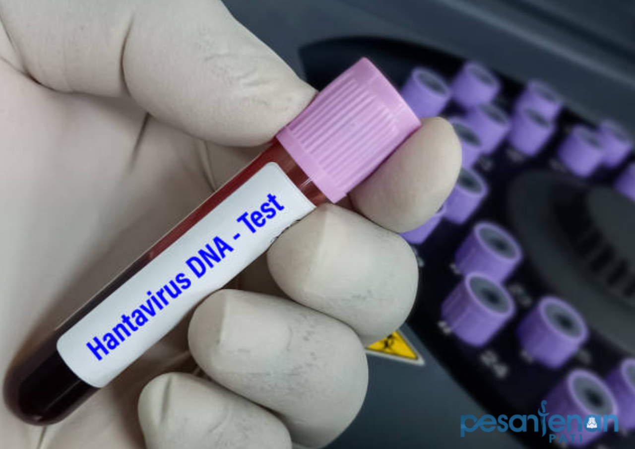 23 Pasien di RI Terpapar Hantavirus Sepanjang 3 Tahun Terakhir