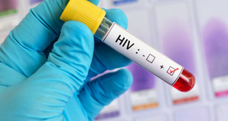 Ilustrasi Dinkes Sidoarjo Bantah Isu Viral yang Menyebut 522 Pelajar Terpapar HIV/AIDS